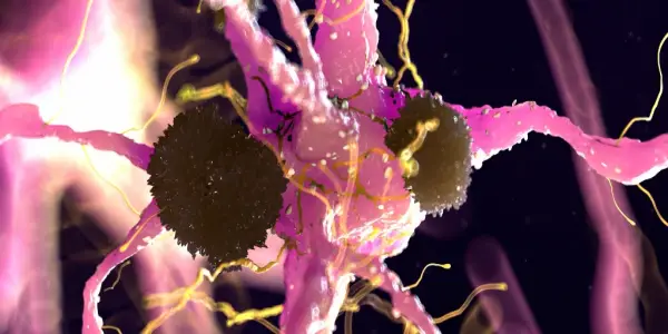 New Research Identifies Brain Protein as Potential Early Indicator of Alzheimer's Disease