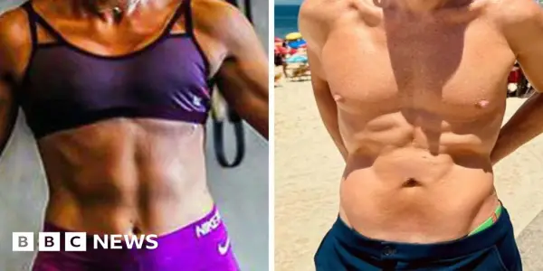 Rising Popularity of Weight-Loss Injections Sparks Health Concerns