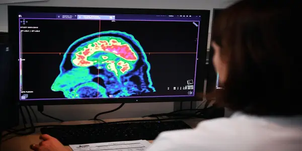 Exploring the Complexities of Gender Differences in Brain Structure