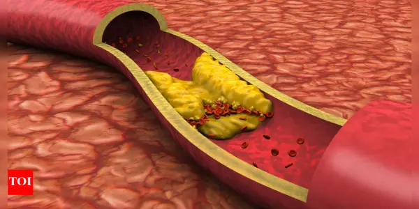 Four Everyday Beverages to Support Arterial Health and Enhance Blood Circulation