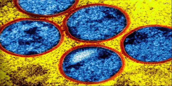 Surge in Whooping Cough Cases in Florida and Other Health Updates