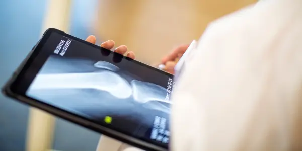 Promising Research Offers Hope for Osteoporosis Treatment