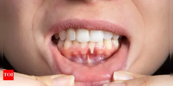 How Your Dental Health Can Reflect Broader Health Issues