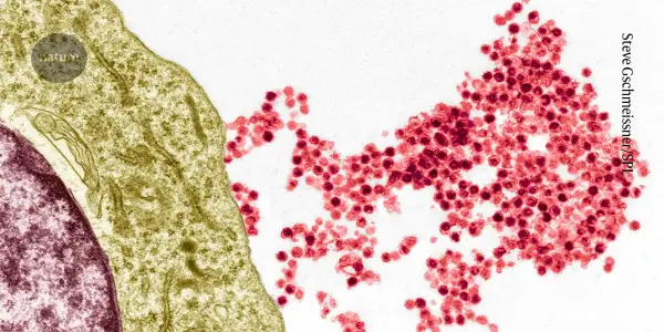 New Insights into Epstein-Barr Virus's Role in Multiple Sclerosis Unveiled